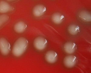 what hemolysis has s.pneumoniae?